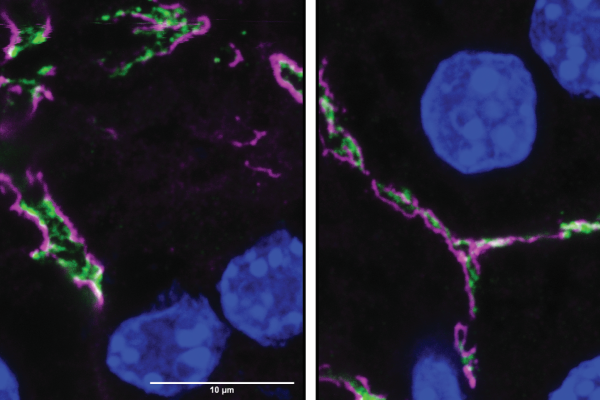 Side-by-side fluorescence micrographs of liver tissue from knockout model.