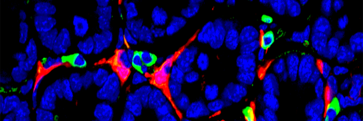 Macrophages and mesenchymal cells surrounded by a group of gut stem cells.