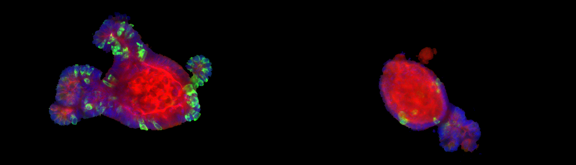 Two collections of bright red cells on a black background, the left is significantly larger than the right with a green perimeter.