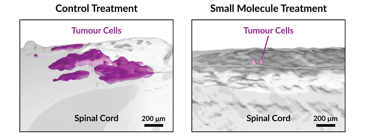 Two side by side blocks show control treatment, with tumour cells spread across the spinal cord, and small molecule treatment, with significantly fewer tumour cells.