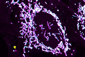 A fluorescent image showing a circle of purple and cyan points, which disperse as they move away from the circle.