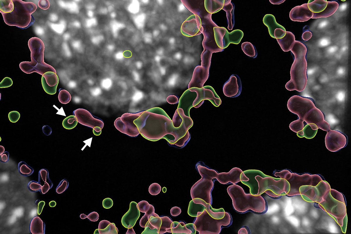 A grey circle surrounded by transparent blue, yellow and pink overlapping irregular shapes. An arrow points to places where all three coloured shapes overlap.