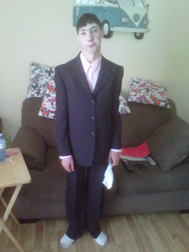 Young man with facial difference wearing a suit.