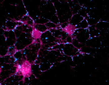 Picture of oligodendrocytes in culture. The picture was taken from neural stem cells cultured in the presence of fractalkine, a novel pro-oligodendrocyte factor identified in the paper.