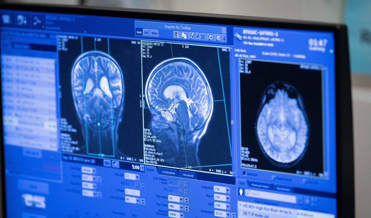 Brain scan: 3 different angles