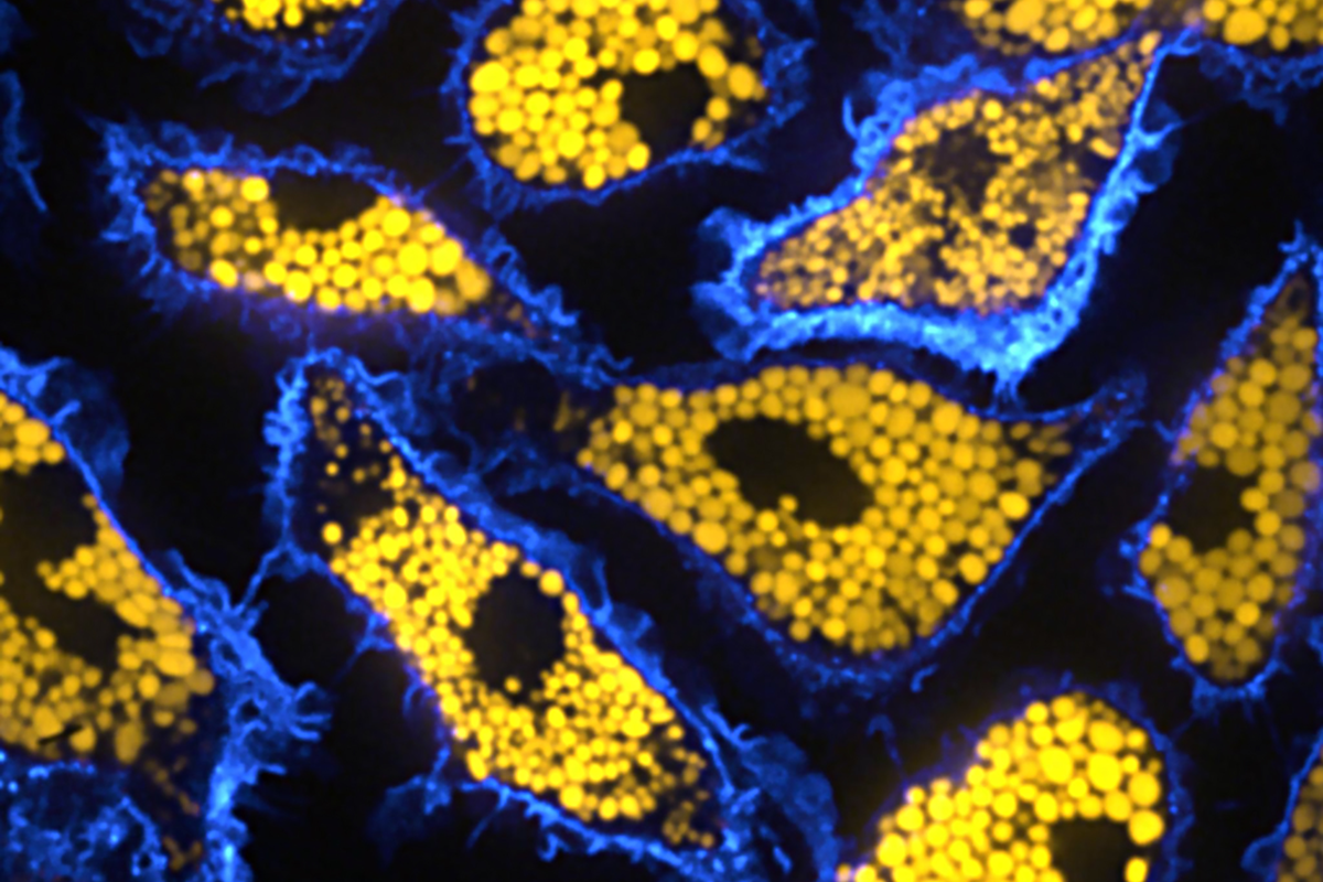 Various oblong shapes outlined in electric blue filled with small circles of yellow against a black background.