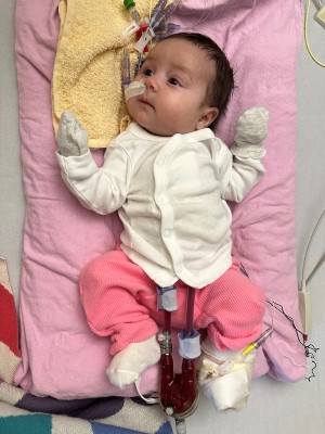 Four-month-old Sloane lying on her back with her VAD device pumping blood through her body.
